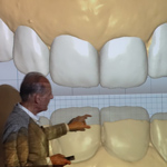 conservative-rehabilitation-of-tooth