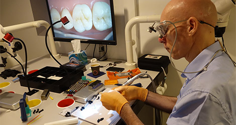 Posterior Bio Esthetic restorations