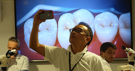 Posterior Bio Esthetic restorations