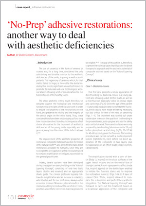 No-Prep-Cosmetic-Dentistry-Sep-2015