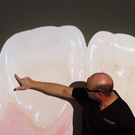 conservative-rehabilitation-of-tooth